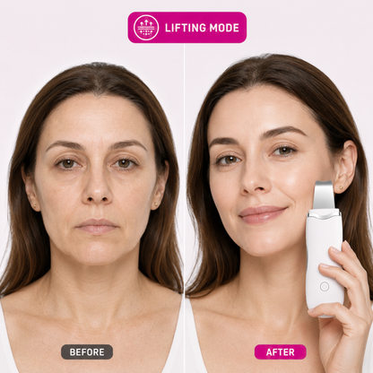 Ultrasonic Skin Scrubber